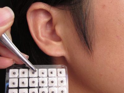 Diagnóstico da Medicina Tradicional Chinesa
